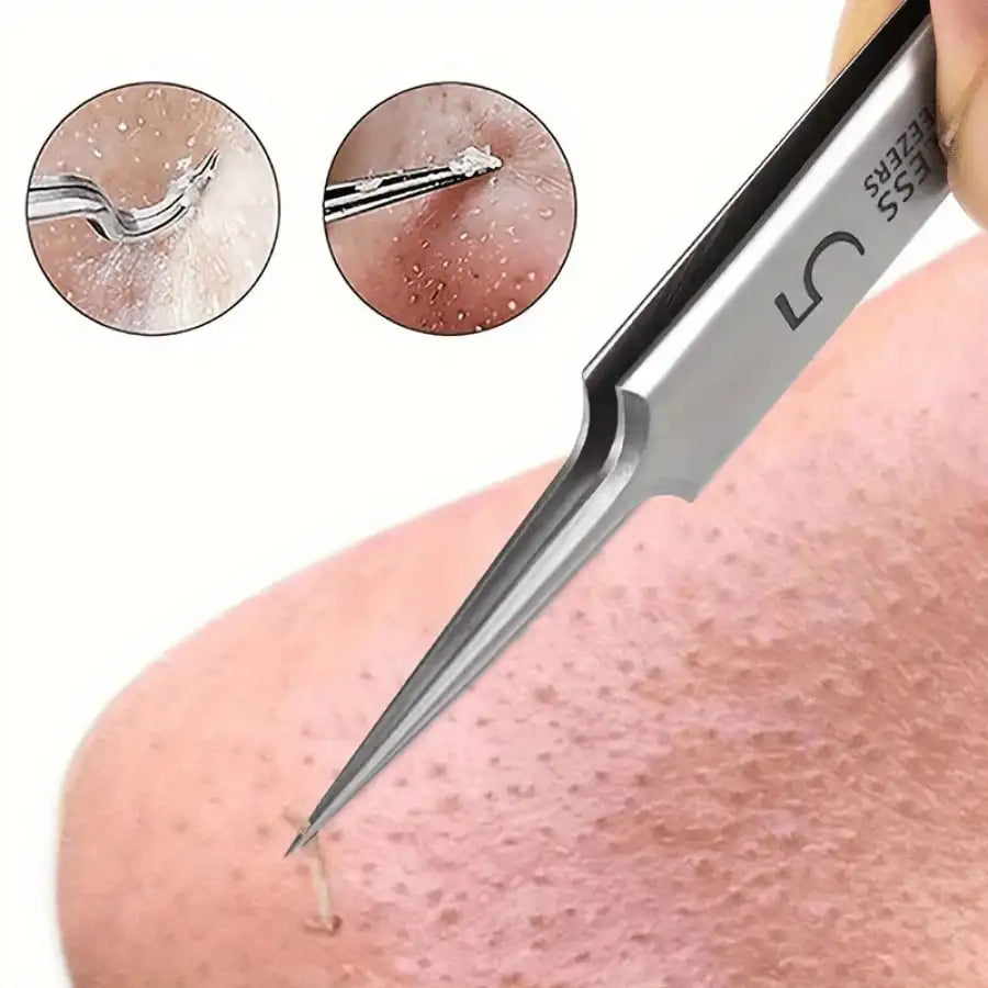 Facial Pore Cleaning Care Tools Ultra Fine Needle Tweezers Blackheads Acne Wart Skin Tag Removal Point Noir Black Head Clip